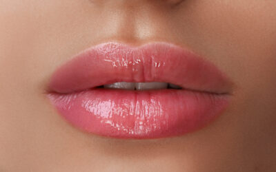 Lift-Lift en Alicante: El Secreto para Labios Armoniosos y Atractivos
