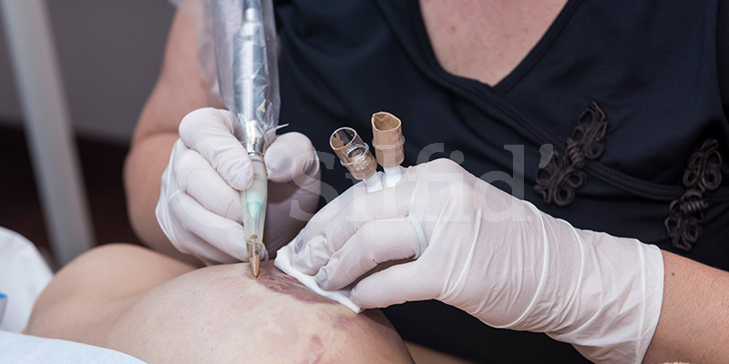 microppigmentacion_alicante_02